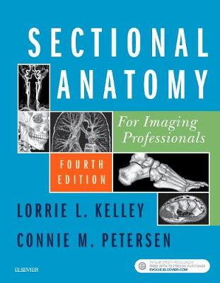 Sectional Anatomy for Imaging Professionals - Click Image to Close