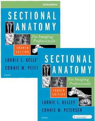 Sectional Anatomy - Bundle - Click Image to Close